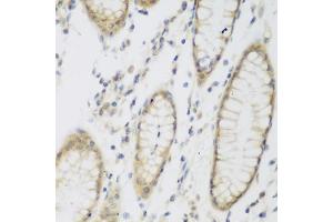 Immunohistochemistry of paraffin-embedded human stomach using NB antibody (ABIN6132989, ABIN6144383, ABIN6144385 and ABIN6223030) at dilution of 1:200 (40x lens).