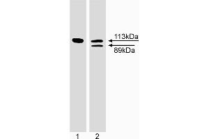 Western blot analysis of PARP cleavage. (PARP1 Antikörper)