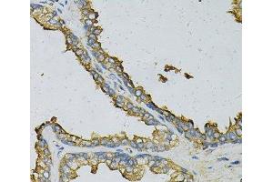Immunohistochemistry of paraffin-embedded Human prostate using RPLP0 Polyclonal Antibody at dilution of 1:100 (40x lens). (RPLP0 Antikörper)