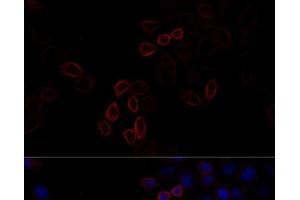 Immunofluorescence analysis of HeLa cells using FLNA Polyclonal Antibody at dilution of 1:100 (40x lens). (Filamin A Antikörper)