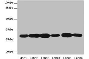 Western blot All lanes: PMM2 antibody at 3. (PMM2 Antikörper  (AA 1-246))