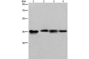 Western Blot analysis of HepG2 and 293T cell, Human kidney cancer tissue and K562 cell using JAM-A Polyclonal Antibody at dilution of 1:500 (F11R Antikörper)