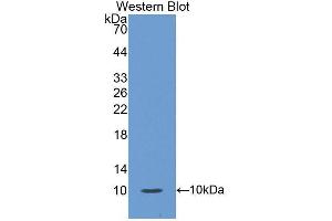Western blot analysis of the recombinant protein. (S100A12 Antikörper  (AA 1-92))