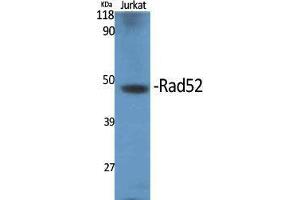 Western Blot (WB) analysis of specific cells using Rad52 Polyclonal Antibody. (RAD52 Antikörper  (Thr56))