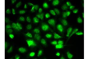 Immunofluorescence analysis of A549 cell using BIRC2 antibody.