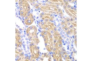 Immunohistochemistry of paraffin-embedded rat kidney using ALDH2 antibody. (ALDH2 Antikörper)