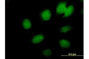 Immunofluorescence of  purified  MaxPab antibody to CBX6 on HeLa cell. (CBX6 Antikörper  (AA 1-412))