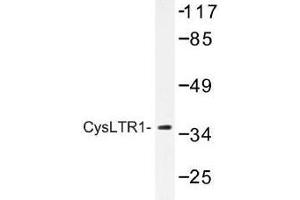 Image no. 1 for anti-Cysteinyl Leukotriene Receptor 1 (CYSLTR1) antibody (ABIN317699) (CysLTR1 Antikörper)