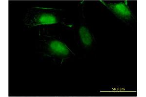 Immunofluorescence of monoclonal antibody to ZNF598 on HeLa cell. (ZNF598 Antikörper  (AA 28-126))