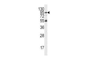 Western blot analysis of PI3KR5 Antibody Pab in K562 cell line lysates (35ug/lane). (PIK3R5 Antikörper  (AA 392-421))