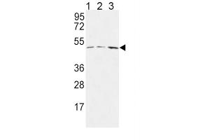 Western Blotting (WB) image for anti-Hyaluronan and Proteoglycan Link Protein 1 (HAPLN1) antibody (ABIN3004323)
