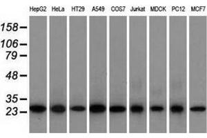 Western blot analysis of extracts (35 µg) from 9 different cell lines by using anti-EMG1 monoclonal antibody. (EMG1 Antikörper)