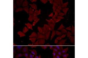 Immunofluorescence analysis of HeLa cells using CCT4 Polyclonal Antibody (CCT4 Antikörper)