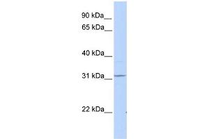 WB Suggested Anti-HHEX Antibody Titration: 0. (HHEX Antikörper  (C-Term))