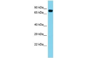 Host: Rabbit Target Name: GGA2 Sample Type: Placenta lysates Antibody Dilution: 1. (GGA2 Antikörper  (N-Term))