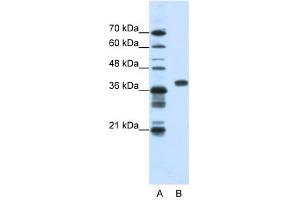 PCBP1 antibody used at 1. (PCBP1 Antikörper)