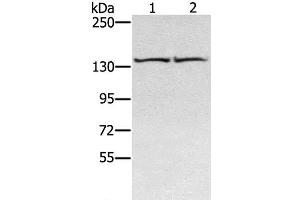 Western Blot analysis of Hela and hepg2 cell using RGS22 Polyclonal Antibody at dilution of 1:400 (RGS22 Antikörper)