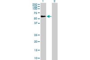 Western Blot analysis of TRIM46 expression in transfected 293T cell line by TRIM46 MaxPab polyclonal antibody. (TRIM46 Antikörper  (AA 1-498))
