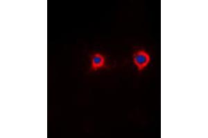 Immunofluorescence (IF) image for anti-Nuclear Factor of Activated T-Cells, Cytoplasmic, Calcineurin-Dependent 3 (NFATC3) (N-Term), (pSer165) antibody (ABIN7301054)