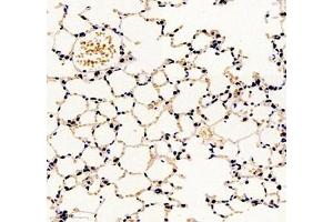 Immunohistochemistry of paraffin embedded mouse lung using groucho (ABIN7075961) at dilution of 1:2000 (300x lens)