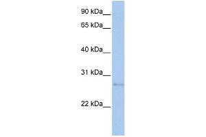 WB Suggested Anti-MDM1 Antibody Titration:  0. (MDM1 Antikörper  (N-Term))