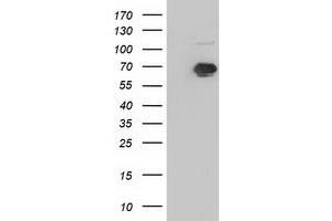 Western Blotting (WB) image for anti-Insulin-Like Growth Factor 2 mRNA Binding Protein 2 (IGF2BP2) antibody (ABIN1498825) (IGF2BP2 Antikörper)