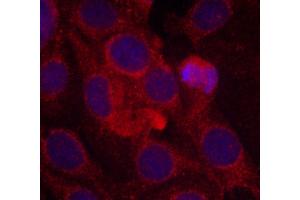 Immunofluorescence staining of methanol-fixed MCF cells using Phospho-KDR-Y1175 antibody. (VEGFR2/CD309 Antikörper  (pTyr1175))