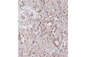 Immunohistochemical analysis of (ABIN656884 and ABIN2846084) on paraffin-embedded Human kidney tissue was performed on the Leica®BOND RXm.