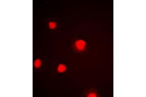 Immunofluorescent analysis of p53 (pS392) staining in HeLa cells. (p53 Antikörper  (C-Term, pSer392))