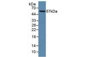 Detection of Recombinant LAMP1, Human using Polyclonal Antibody to Lysosomal Associated Membrane Protein 1 (LAMP1) (LAMP1 Antikörper  (AA 49-297))