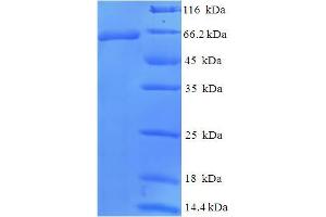 SDS-PAGE (SDS) image for Wilms Tumor 1 (WT1) (AA 1-449), (full length) protein (His-SUMO Tag) (ABIN5710628) (WT1 Protein (AA 1-449, full length) (His-SUMO Tag))