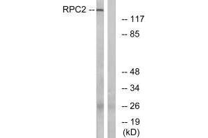 Western blot analysis of extracts from LOVO cells, using RPC2 antibody.