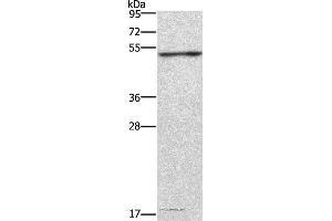 Western blot analysis of Jurkat cell, using CKMT2 Polyclonal Antibody at dilution of 1:700 (CKMT2 Antikörper)