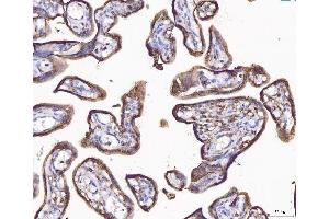 IHC analysis of ANXA4 using anti-ANXA4 antibody (ABIN5518805).