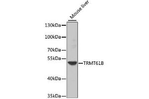 Western blot analysis of extracts of mouse liver, using TRMT61B antibody. (TRMT61B Antikörper  (AA 1-250))