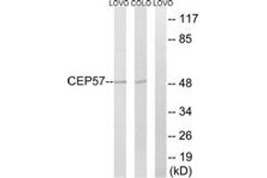 Western blot analysis of extracts from COLO/LOVO cells, using CEP57 Antibody.