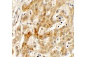Immunohistochemistry (IHC) image for anti-Transmembrane Protein 106B (TMEM106B) (N-Term) antibody (ABIN1031627) (TMEM106B Antikörper  (N-Term))