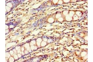 Immunohistochemistry of paraffin-embedded human colon tissue using ABIN7157727 at dilution of 1:100 (KLF4 Antikörper  (AA 30-230))