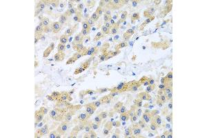 Immunohistochemistry of paraffin-embedded human liver using CCL3 antibody at dilution of 1:100 (40x lens). (CCL3 Antikörper)