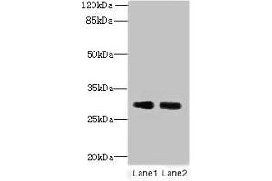Western blot All lanes: DNALI1 antibody at 1 μg/mL Lane 1: Mouse gonadal tissue Lane 2: Mouse lung tissue Secondary Goat polyclonal to rabbit IgG at 1/10000 dilution Predicted band size: 30, 16 kDa Observed band size: 30 kDa (DNALI1 Antikörper  (AA 1-258))