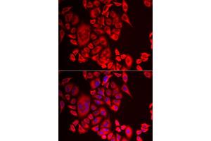 Immunofluorescence analysis of MCF-7 cell using QPCT antibody. (QPCT Antikörper)