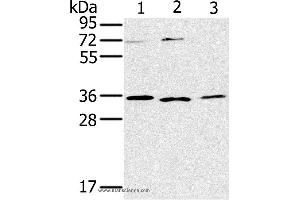 Western blot analysis of SP20, Raji and 231 cell, using IL22RA2 Polyclonal Antibody at dilution of 1:200 (IL22RA2 Antikörper)