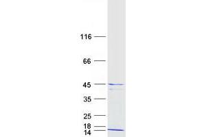 Western Blotting (WB) image for H2A Histone Family, Member Y (H2AFY) (Transcript Variant 2) protein (Myc-DYKDDDDK Tag) (ABIN2722381)