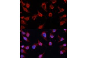 Immunofluorescence analysis of HeLa cells using Caspase-8 antibody (ABIN6131531, ABIN6137971, ABIN6137973 and ABIN6215162) at dilution of 1:100. (Caspase 8 Antikörper)