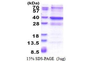 SDS-PAGE (SDS) image for Glycine-N-Acyltransferase-Like 2 (GLYATL2) (AA 1-294) protein (His tag) (ABIN5853534) (GLYATL2 Protein (AA 1-294) (His tag))