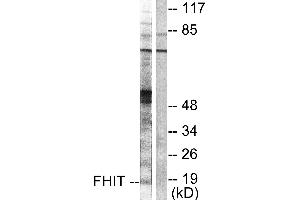 Western blot analysis of extracts from A549 cells, using FHIT antibody (#C0193). (FHIT Antikörper)