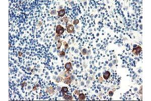 Immunohistochemistry (IHC) image for anti-Dipeptidylpeptidase 10 (DPP10) antibody (ABIN1497834) (DPP10 Antikörper)