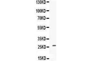 Western blot analysis of CNTF expression in MCF-7 whole cell lysates (lane 1). (CNTF Antikörper  (AA 12-200))