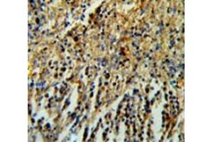 Immunohistochemistry analysis in human spleen tissue (Formalin-fixed, Paraffin-embedded) using PHTNS  Antibody  (N-term), followed by peroxidase conjugation of the secondary antibody and DAB staining. (KIAA1949 Antikörper  (N-Term))