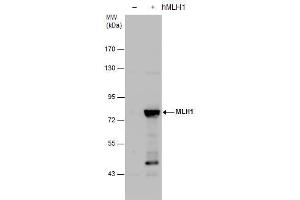 WB Image MLH1 antibody detects MLH1 protein by western blot analysis. (MLH1 Antikörper)